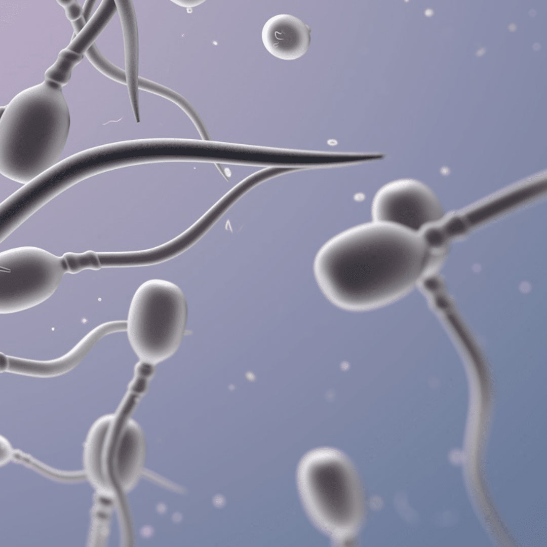 ¿Qué es la azoospermia?