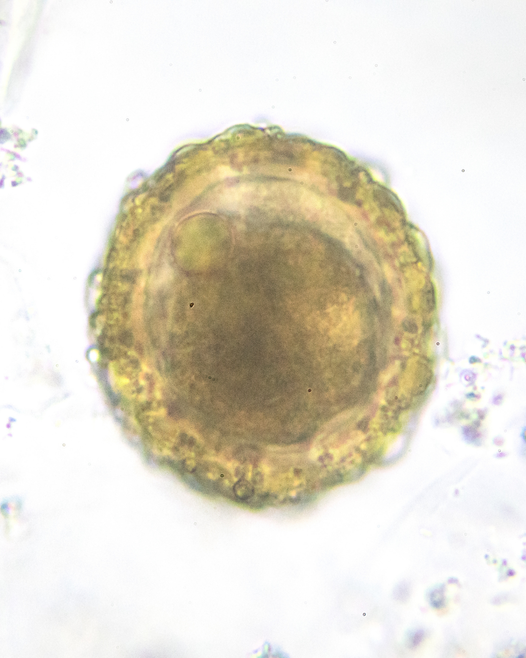 ¿Qué es la ovulación inducida?