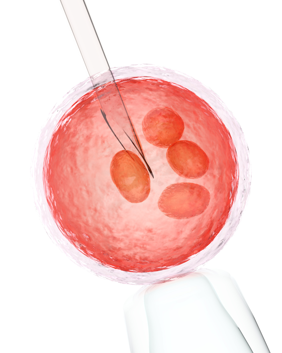 Inseminación Intrauterina: Un Camino Hacia la Fertilidad
