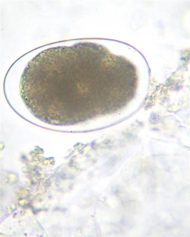 Reserva ovárica: el reloj biológico que influye en la fertilidad